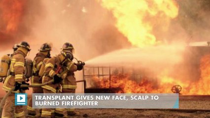 Transplant Gives New Face, Scalp to Burned Firefighter