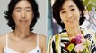 Korean Plastic Surgery- Shocking Before And After Photos-1