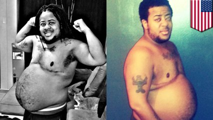 Transgender man gets pregnant, gives birth 10 years after hormone therapy