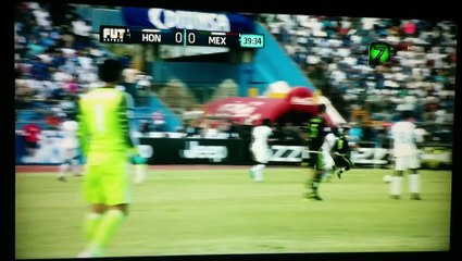 Garrido horror injury against Mexico