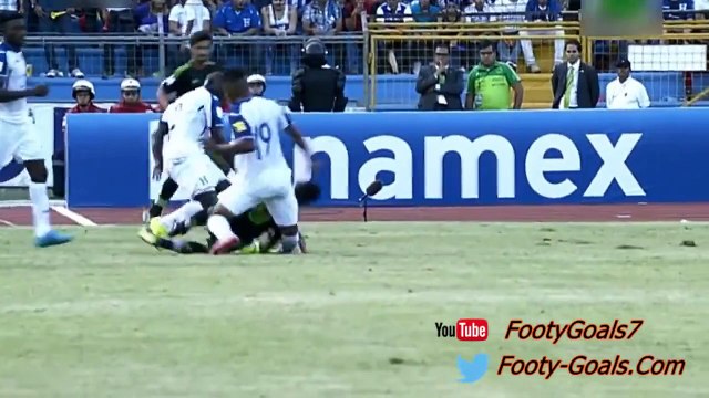 Honduras player, Luis Garrido snaps his leg in half!