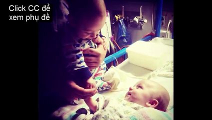 Bộ ảnh về sự gắn bó đặc biệt của các cặp song sinh