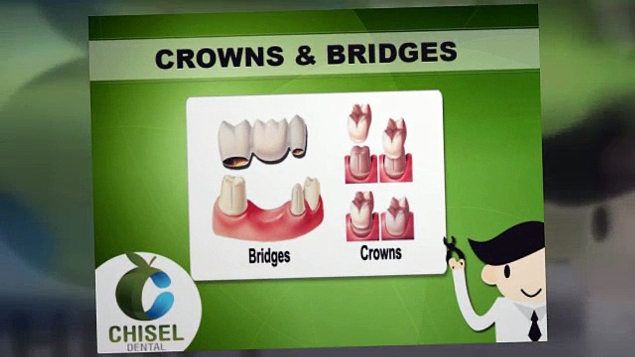 Chisel Dental Clinic