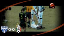 Cenas fortes: Jogador de Honduras sofre grave lesão em amistoso contra o México