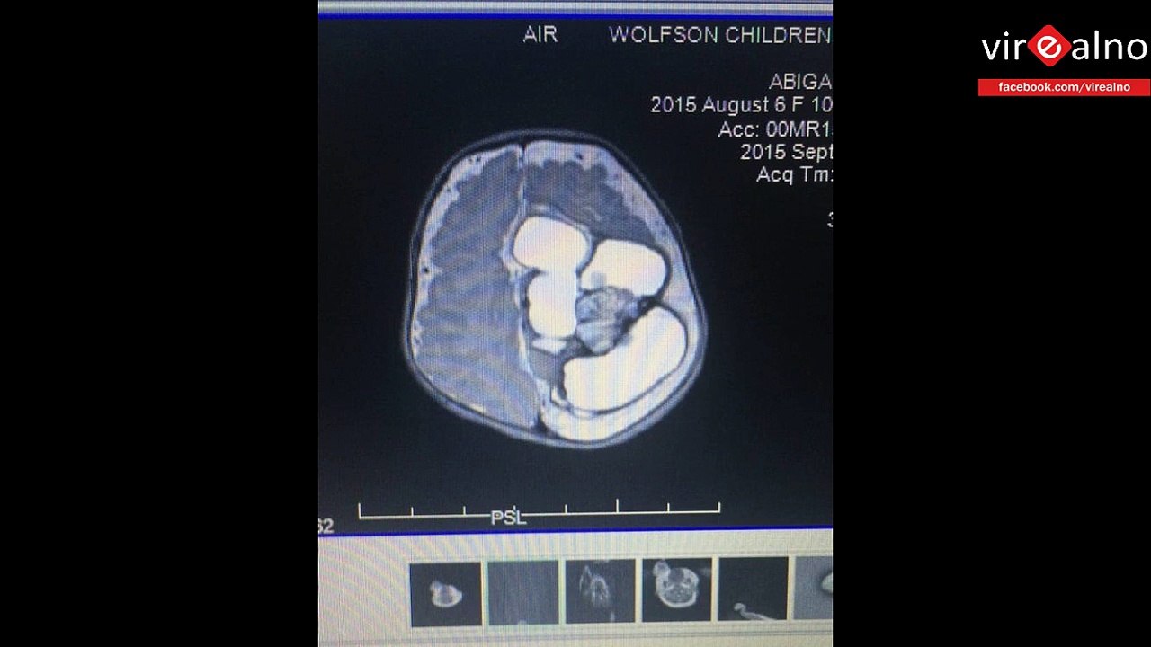 Abigail's Joy