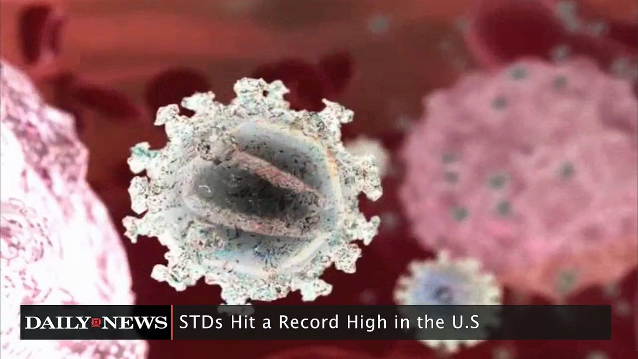 STD's on the Rise