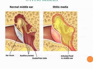 Dr Meena Nihalani@08527450737@ ( ENT Specialist  in Indirapuram)-