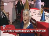 Alzheımer hastalığına erken tanı koyan cihaz Türkiye'de