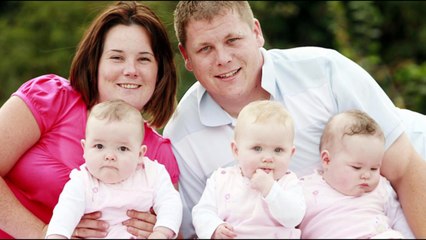 8 People With Extra Body Parts