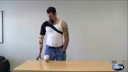 Une prothèse controlée par la pensée