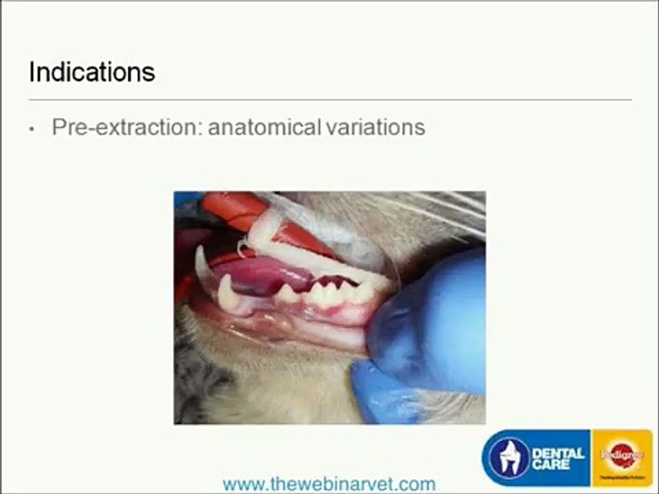 Popular Radiography & Dental radiography videos