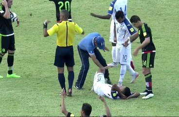 Luis Garrido leg injury!