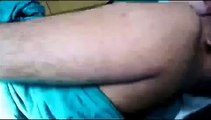 Sebaceous Cyst Left Arm