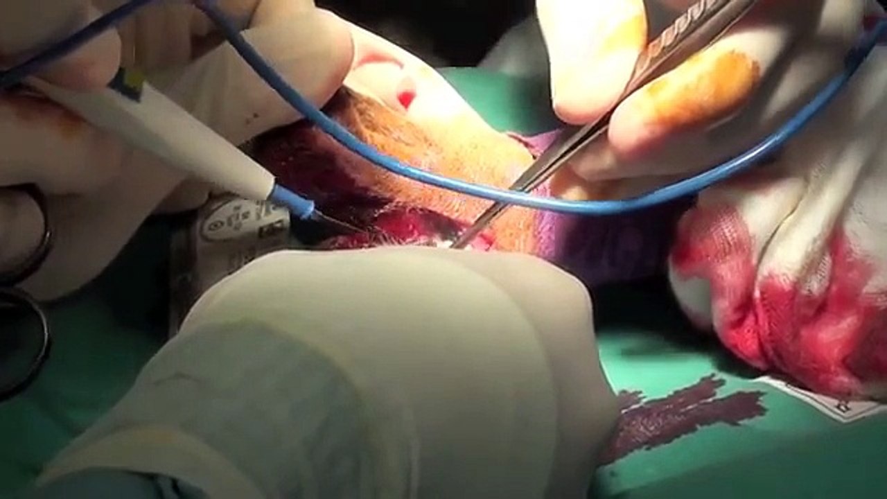Surgical Procedures