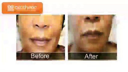 Aesthetic Laser and Vein Center - Cosmetic surgery Before and After looks