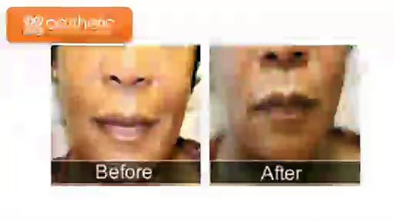 Aesthetic Laser and Vein Center - Cosmetic surgery Before and After looks