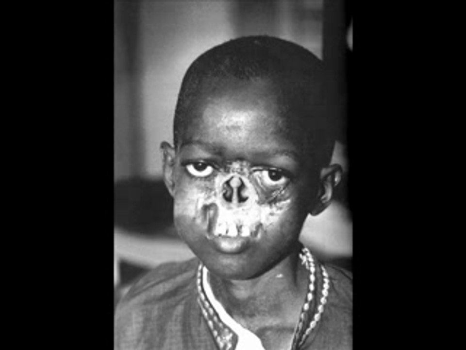 enfant du monde