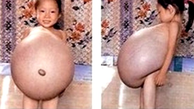 ДЕВОЧКА РОДИЛА в 5 ЛЕТ! САМАЯ МОЛОДАЯ МАМА В МИРЕ - Лина Ванесса Медина