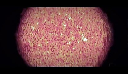 Death of Sun #Mind Blow (full Documentary) 2015 ★ Documentary ★