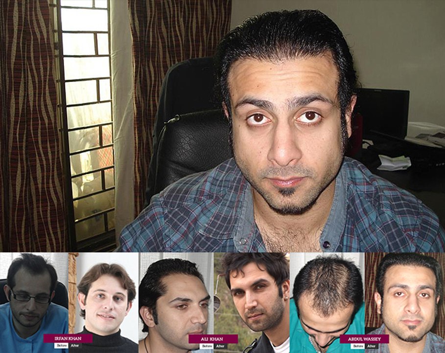 Elixir Hair Transplant Centre