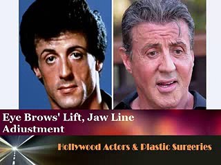 Hollywood Male Celebs You Didn’t Know Had Plastic Surgery