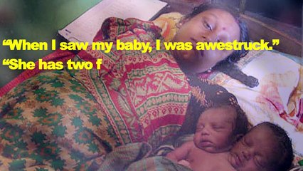 Baby Girl With TWO HEADS