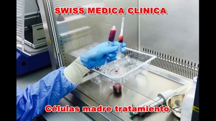 Clinica esclerosis multiple