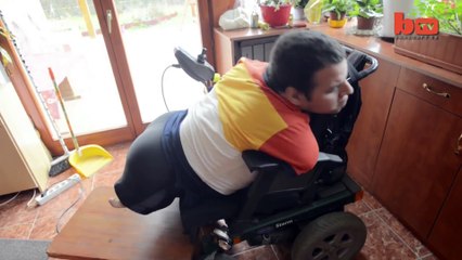 Abandonné par sa mère car il est né sans membres, admirez ce qu'il est devenu 22 ans plus tard!