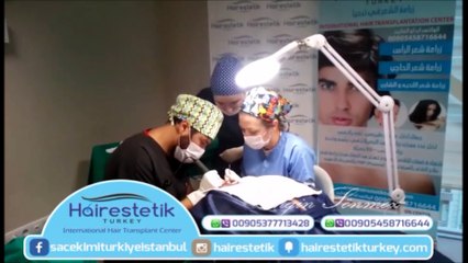 Greffe de cheveux turquie