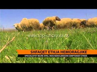 Shfaqet ethja hemoragjike - Top Channel Albania - News - Lajme