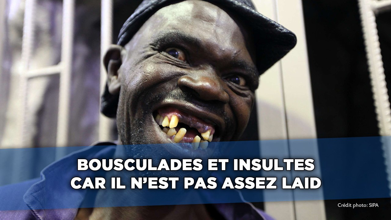 Zimbabwe: Bousculades et insultes car il n'est pas assez laid
