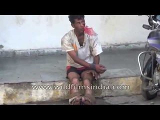 Mentally challenged man assaulted in Surajpol Police Station, Udaipur