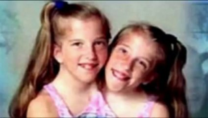 Conjoined Twins Abby and Brittany's New TLC - two head -