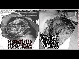 HEPATOBILIARY TUBELIKE STRUCTURES DEFICIENCY- demo CDr 1