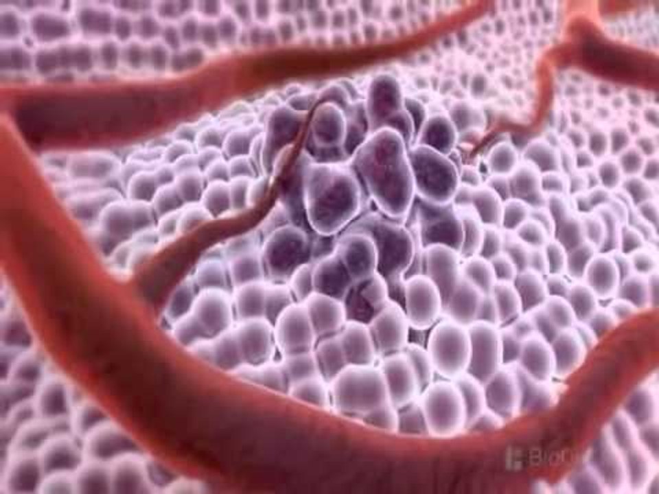 LIMONI KURON KANCERIN SHKENCETARET THONE SE VITAMINA C NDALON SEMUNDJEN E RENDE LAJM