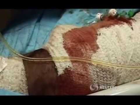 PERGJAKET IRAKU DHJETRA TE VRARE NE SULME ME BOMBE NE TE GJITHE IRAKUN LAJM