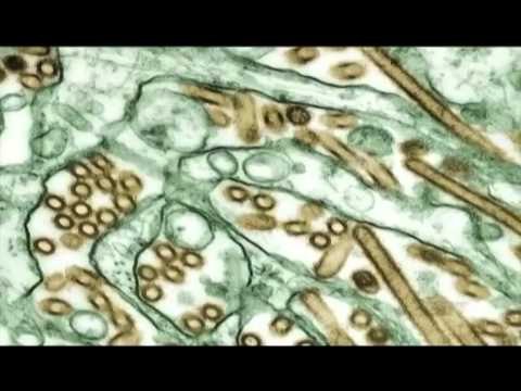 GRIPI I PULAVE NE KANADA NE QYTETIN E ALBERTAS KONFIRMOHET NJE VIKTIME E VIRUSIT H5N1 LAJM