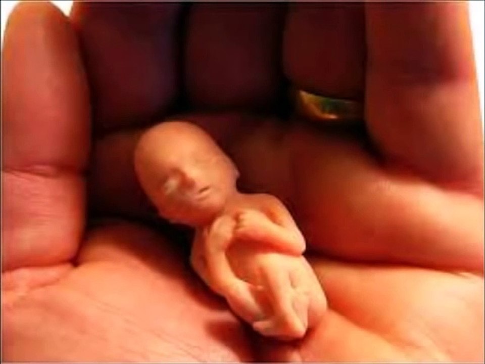 10 weeks pregnant, 10 weeks pregnant symptoms, 10 weeks pregnant pictures