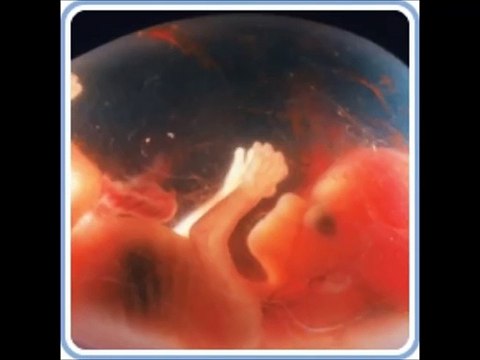 12 weeks pregnant, 12 weeks pregnant belly, 12 weeks pregnant symptoms