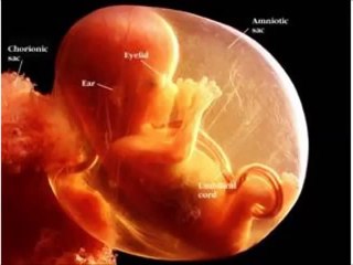 14 weeks pregnant, 14 weeks pregnant symptoms, 14 weeks pregnant belly