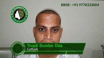 Hair Restoration Surgery Testimonials and Reviews - T. Das - HHY