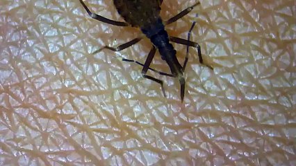 Kissing bug feeding on a human