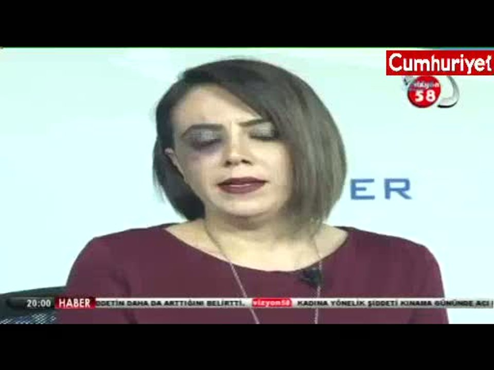 Canlı yayına morarmış gözle çıktı