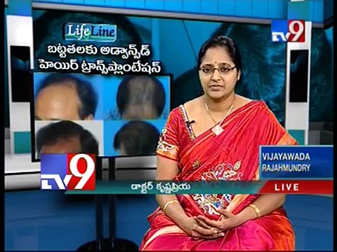 Best Hair Transplant Clinics in Hyderabad