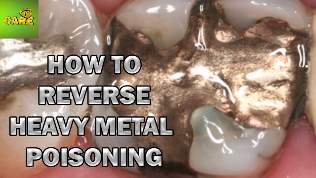 How to Reverse Heavy Metal Poisoning | Dinah Doong | Care TV