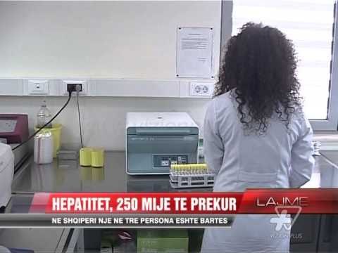 Hepatitet, 250 mije te prekur - News, Lajme - Vizion Plus