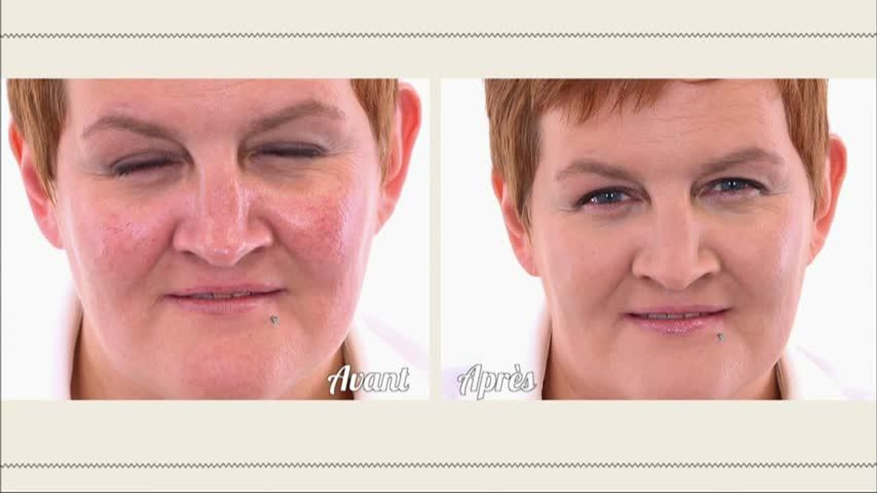 Comment masquer la couperose ?