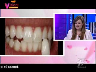 Скачать видео: Vizioni i pasdites - Kujdesi dentar - 30 Shtator 2014 - Show - Vizion Plus