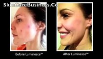 Jeunesse Global LUMINESCE™  BEFORE & AFTER RESULTS