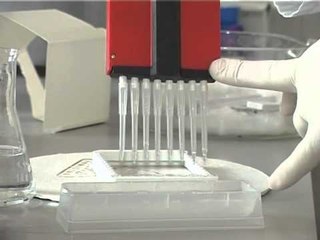 DITA BOTERORE E VIRUSIT “AIDS”,5 FEMIJE LINDEN TE INFEKTUAR PASI NEGLIZHUAN TESTIN LAJM